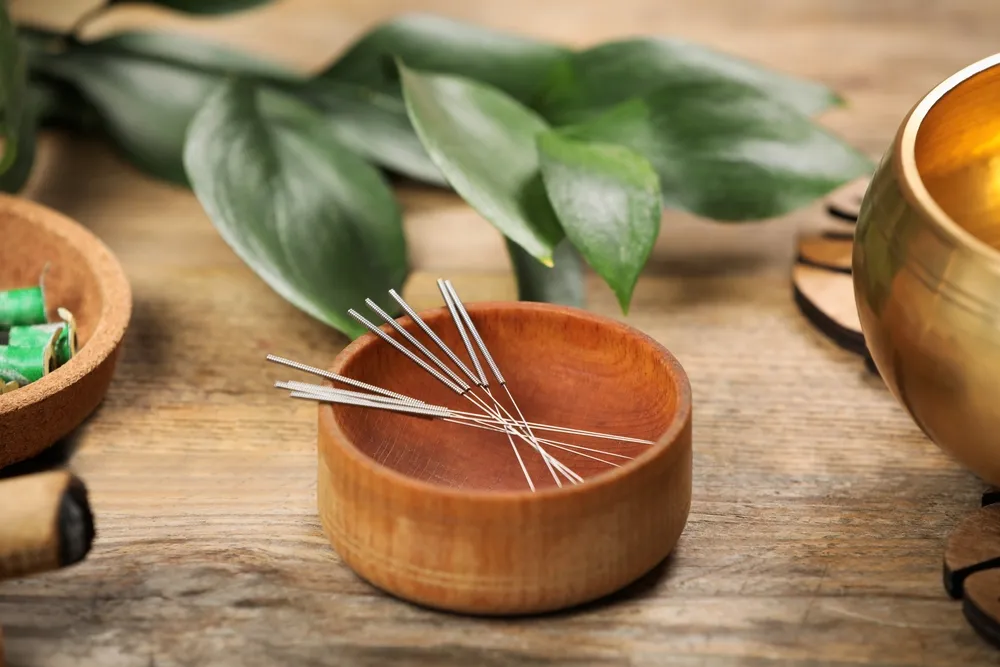 Acupuncture Treatment